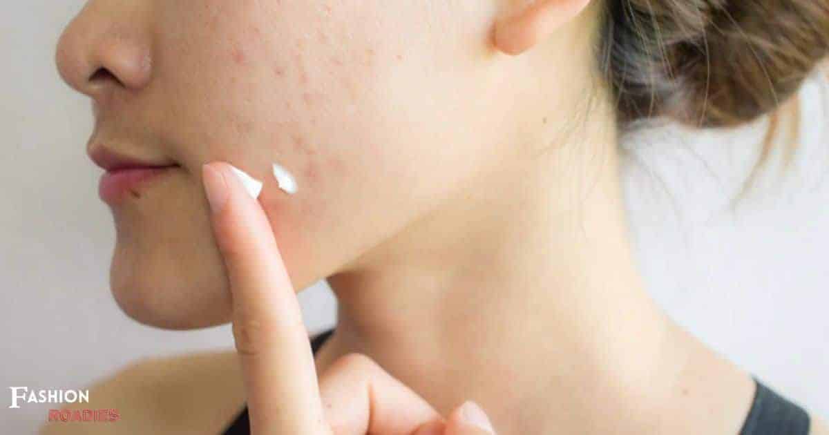 What Is Propanediol In Skin Care